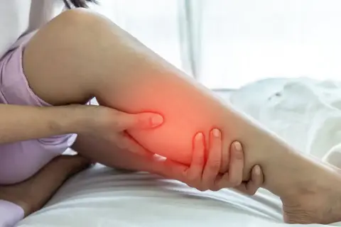 Une personne se tient la jambe, une zone rouge vif sur le mollet indiquant une douleur.