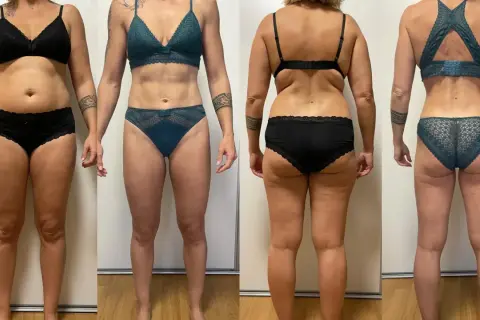 Avant/après : une femme en lingerie noire puis en lingerie verte. Elle a visiblement réussi à perdre 10 kg.