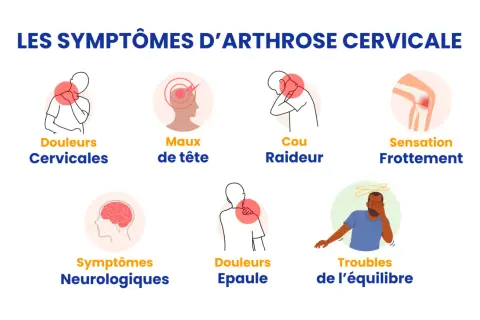 Illustrations des symptômes de l'arthrose cervicale : douleurs cervicales, maux de tête, cou raideur, sensation frottement, symptômes neurologiques, douleurs épaule, troubles équilibre.