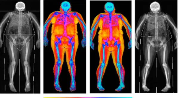 Radiographies et thermographies corporelles montrant une transformation : je m'affine mais je prends du poids. Les couleurs chaudes indiquent la graisse, les bleues les os.