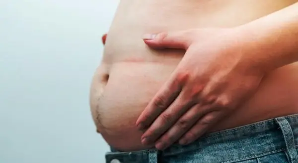 Une main touche un ventre proéminent, soulevant la question : le pain complet fait-il grossir le ventre ?