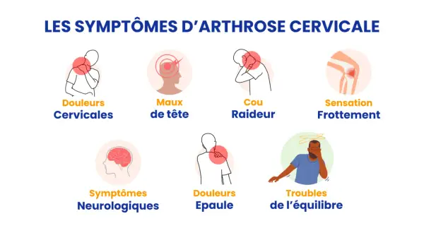 Illustrations des symptômes de l'arthrose cervicale : douleurs cervicales, maux de tête, cou raideur, sensation frottement, symptômes neurologiques, douleurs épaule, troubles équilibre.